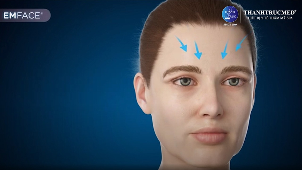 EMFACE – Công nghệ trẻ hóa không xấm lấn hiện đại bật nhất thế giới